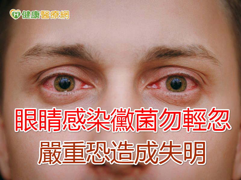 眼睛感染霉菌勿轻忽 严重恐造成失明