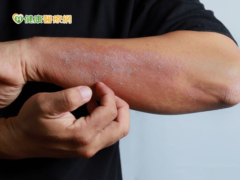 小心蜂窝性组织炎