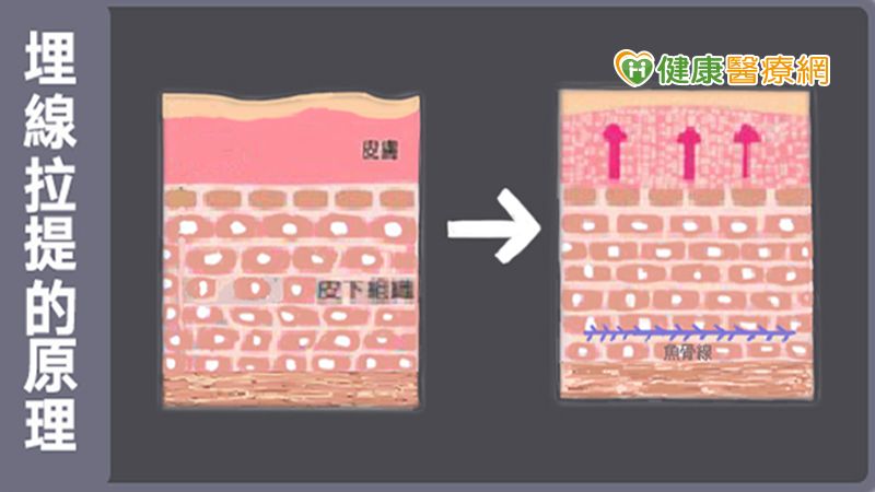 新聞圖片