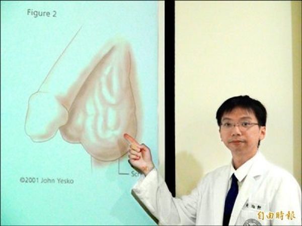 阴囊摸到虫?精索静脉曲张 恐不孕