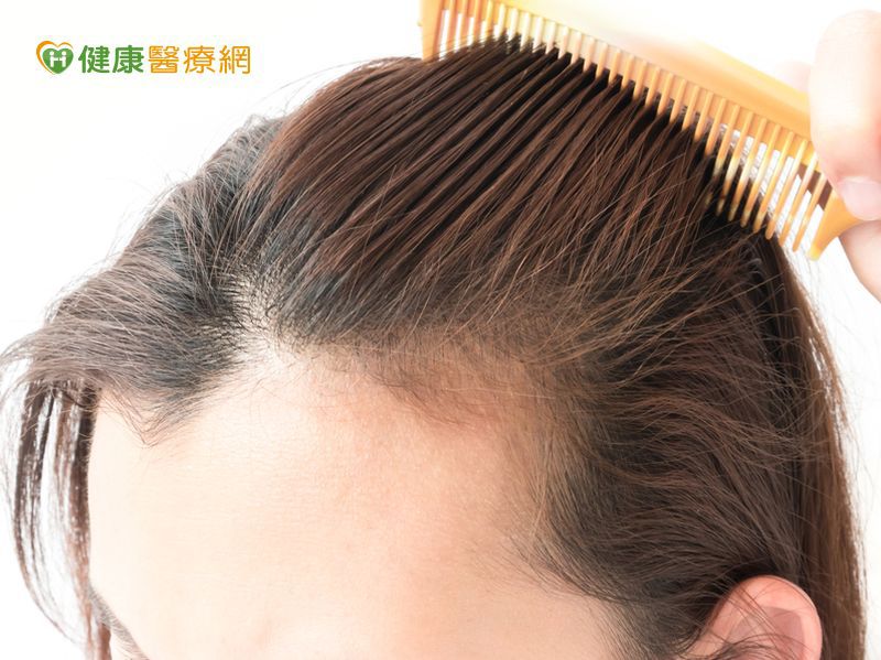 化療後頭髮會長回來　稀疏髮量有方法可改善