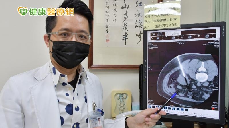 孫宏舜醫師表示，腎臟細胞癌的常規治療方式仍以手術切除為主，但若符合冷凍治療的條件，也是一個選擇方向。
