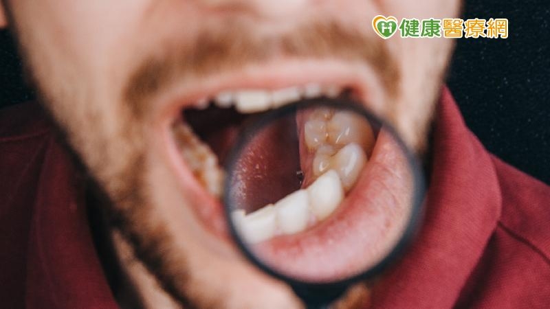 中年男嘴角潰瘍以為免疫力差　醫苦勸：這是口腔癌
