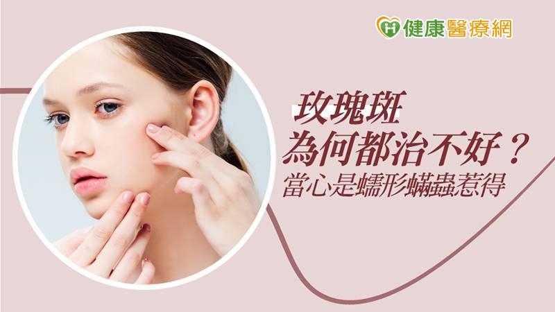 患有玫瑰斑的病人，最困擾的就是症狀會反覆的發作，有時候明明控制得好好的，但只要遇到天氣變化，特別是高溫，或是運動流汗、長時間戴著口罩、情緒的變化、睡眠不足等，這些因素都會促使玫瑰斑變得不穩定。