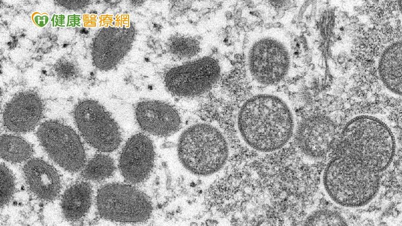 猴痘病毒（翻攝自美聯社AP）