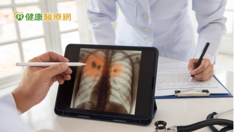 LDCT是目前唯一具國際實證，可以早期發現肺癌的篩檢工具，能降低重度吸菸者20%肺癌死亡率。