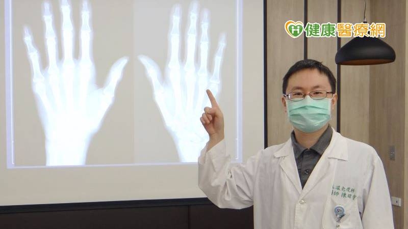 奇美醫學中心風濕免疫科主治醫師陳昭宇表示：手部退化性關節炎，嚴重恐侵蝕關節，手部退化性關節炎應適當休息及遵從醫囑，以免惡化。