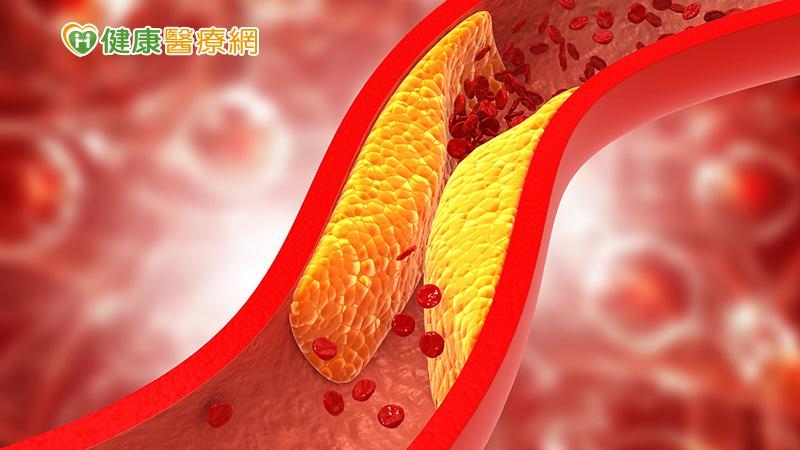 黃麗珊指出，遺傳、用藥、飲食習慣、疾病都有可能是造成高膽固醇的因素。