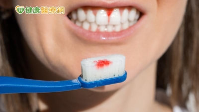 年輕人刷牙流血藏危機！恐是「青年型牙周病」