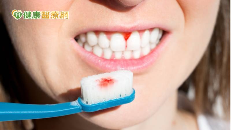 近年來發現年紀約20歲左右青少年族群，也出現「青年型牙周病」症狀，共同問題都是「口臭」、「刷牙會流血」以及「喝冰水會痠」等，甚至有人已經出現牙齦萎縮等前兆。