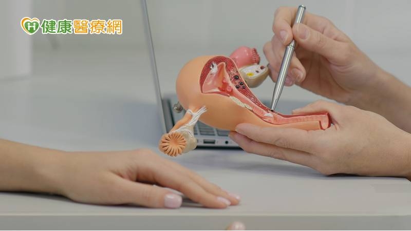 55歲陳小姐停經後仍有出血症狀，經透過子宮腔鏡檢查發現5公分腫瘤，確診為子宮內膜癌第三期，利用免疫療法及細胞治療，讓她揮別罹癌夢魘。