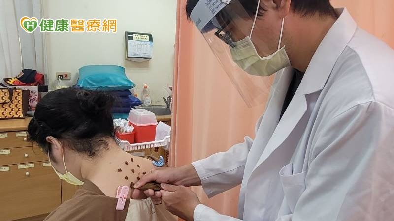 中榮嘉義分院推出「三伏天穴位敷貼」特別門診，幫助民眾預防、治療多種慢性肺系疾病。