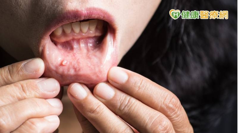 口腔癌是最容易自我發現的癌症，建議有嚼食檳榔習慣的朋友若發現口腔黏膜的顏色或形狀改變、嘴唇或口腔有超過兩週以上不癒合的潰瘍、口腔出現不明原因之腫塊或出血、吞嚥咀嚼困難、喉嚨有異物感，應立即就醫檢查。