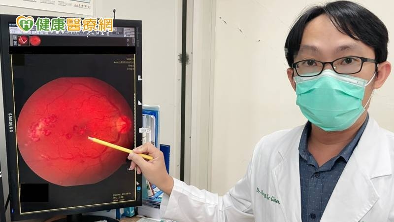 江先生不菸不酒沒有不良嗜好，也無慢性疾病或家族史，日前因右眼視力模糊持續一周，加上視網膜出血，進一步檢查，竟發現罹患「慢性骨髄性白血病（CML）」，所幸透過口服藥物治療後病情獲得控制。