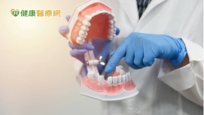 缺牙該植牙還是做活動假牙？　牙科醫師詳解