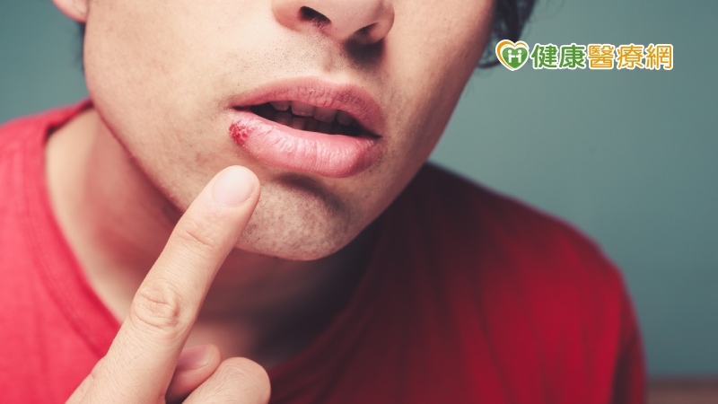 男子嘴巴破皮1 年　就醫檢查驚罹口腔癌