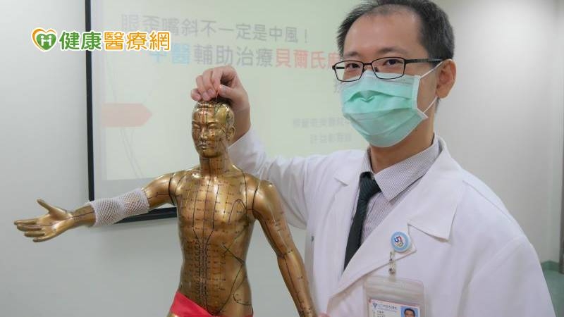 許益彰醫師說明，一般來說貝爾氏麻痺在發生後的前幾天，顏面肌肉無力的情形會逐漸惡化，約一周後症狀才會穩定，大部分會在第二、三周開始好轉