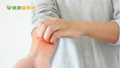 冬季癢又來亂！　中醫：減少刺激、內服外用改善