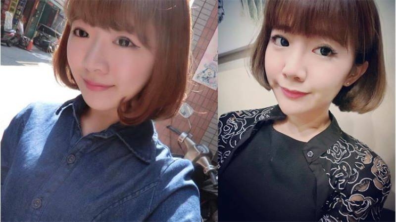 卡麥拉隆鼻、光滑面隆乳術前
