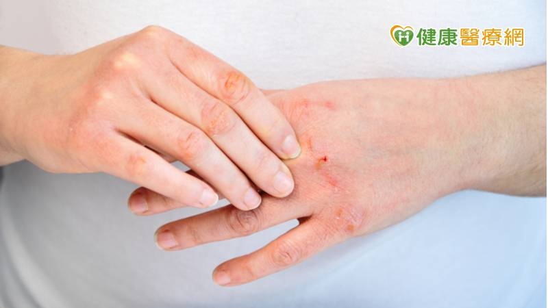 想要維持手部肌膚柔嫩，可留意洗手時的水溫、塗抹護手霜、適度去角質、防曬、讓手部休息及補充水分等方式來保護雙手。
