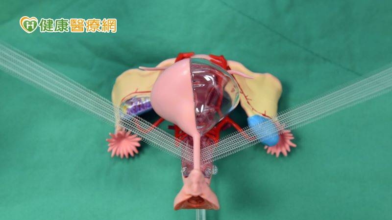 恩主公醫院婦產科呂佳澍醫師指出，許多產後及更年期女性會有頻尿與漏尿的尿失禁問題，通常在咳嗽、打噴嚏、大笑或突然站起來時無法控制的漏尿，又稱為「應力性尿失禁」。
