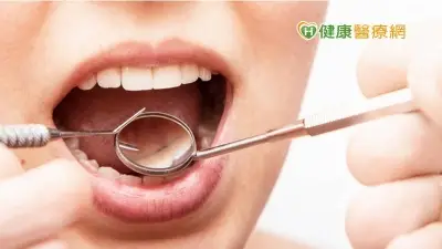 牙齒問題勿輕忽　注意牙周病警訊