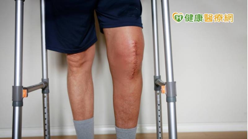 中年茶農採茶腳軟無力　「人工膝關節置換」擺脫疼痛