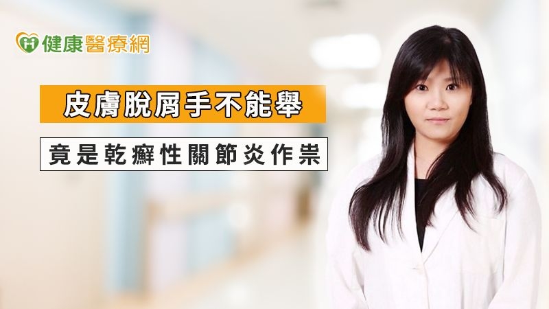 皮膚脫屑手不能舉　竟是乾癬性關節炎作祟