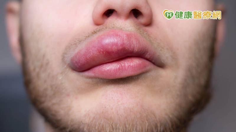 口腔癌術後掛肉團、流口水　高醫攜手金屬工業中心完美解決