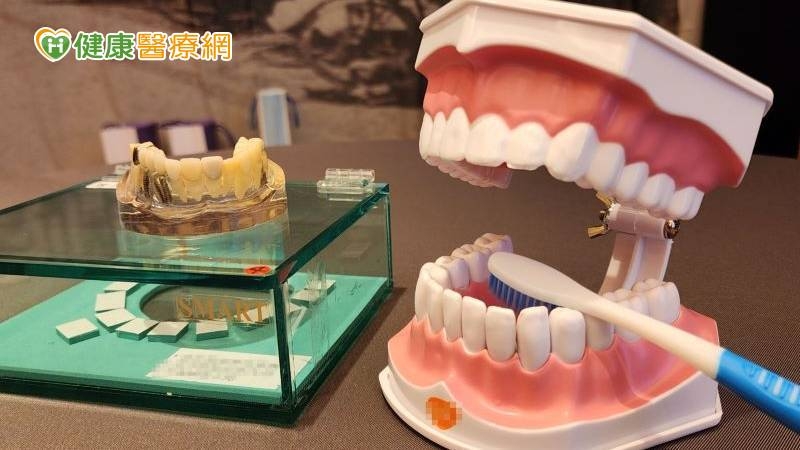 人工植牙不易蛀牙？　醫提醒「１因素」恐害打掉重來