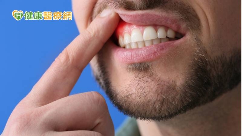 沒有牙痛卻患牙周病？　醫直指「關鍵原因」：當心會遺傳