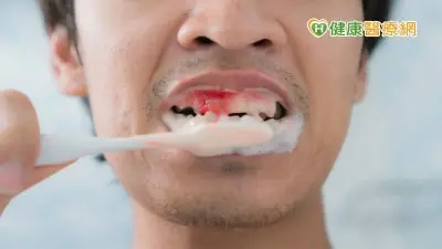 降低牙周病機率　你應該「這樣刷牙」才對！