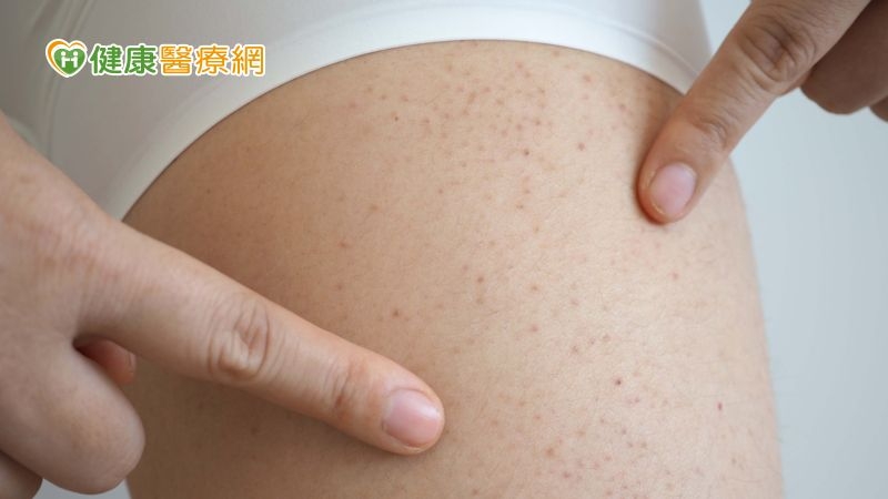 空姐罹病嚴重出血　再生不良性貧血如何覓得生機？