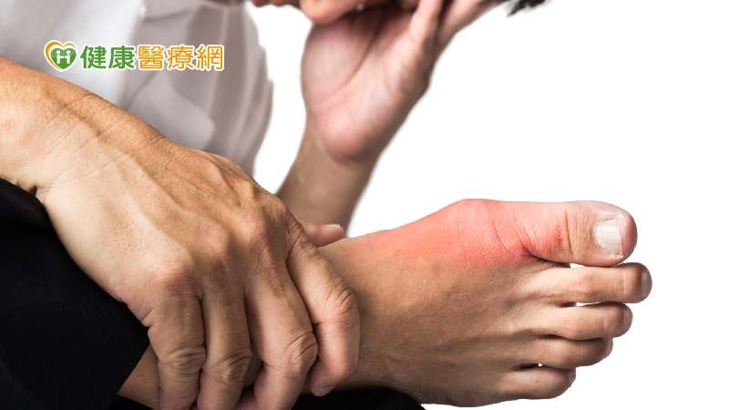 痛風發作時該怎麼做？　營養師建議做這5件事、避免4類食物