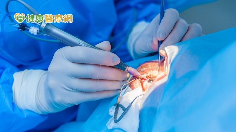 逾千人等待眼角膜移植　「電紡紗」人工角膜可促進神經再生