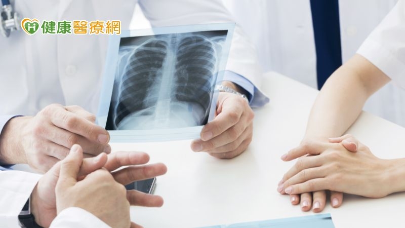 肺癌死亡率高居第一！　權威醫籲治療前先了解「3件事」