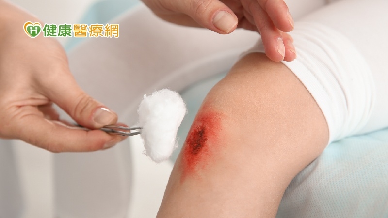 紅黃綠黑有什麼不同？　一次搞懂傷口的4種顏色食藥署