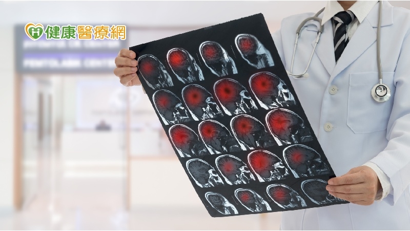 龍巖總裁李世聰病逝享壽65歲　凸顯腦瘤危險性！