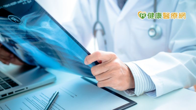 小細胞肺癌治療如何選擇？　醫師逐一解析放療、化療、免疫治療