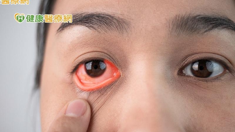 春季乾旱冷氣吹整晚　當心「極度乾燥」眼睛紅通通