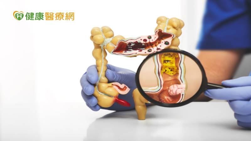 他一周沒「大號」腹痛就醫　檢查驚見「腸腫瘤」堵住通道