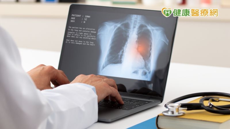 打破小細胞肺癌魔咒　免疫療法助患者重返職場