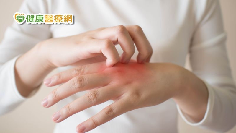 治療新知！棘手「結節性癢疹」不再沒藥醫　FDA核准第1個治療藥