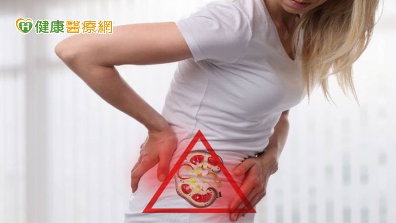 婦人腎結石又尿路狹窄取石超困難！　「新工具」一舉兩得助攻