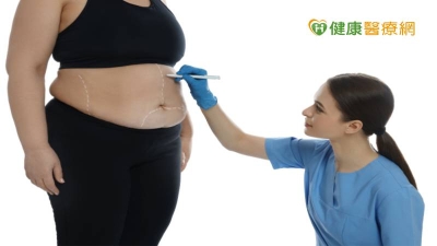 太胖加上罕見胃部、腸道方向相反　台灣成功完成世界首例「內臟異位」縮胃曠腸減重手術
