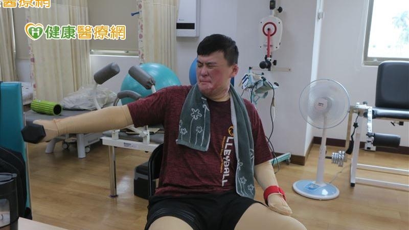 全身64.5%燒傷、手術逾20次　排球健將截肢忍痛復健
