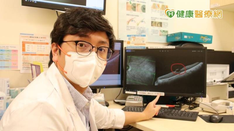 開完白內障還是霧煞煞　「玻璃體黃斑部牽扯症」是真兇