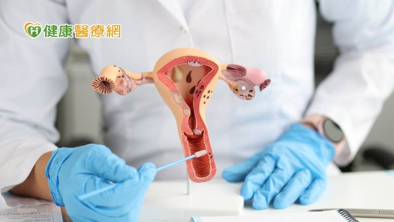 子宮頸抹片檢查前要注意哪些？篩檢異常怎麼辦？　子宮頸癌篩檢一次看！