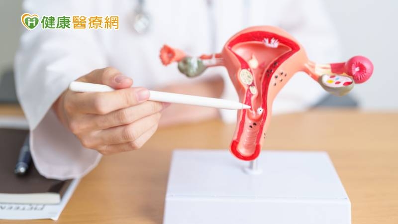 暈厥就醫才知17公分肌瘤致子宮破裂　婦二次手術保性命！