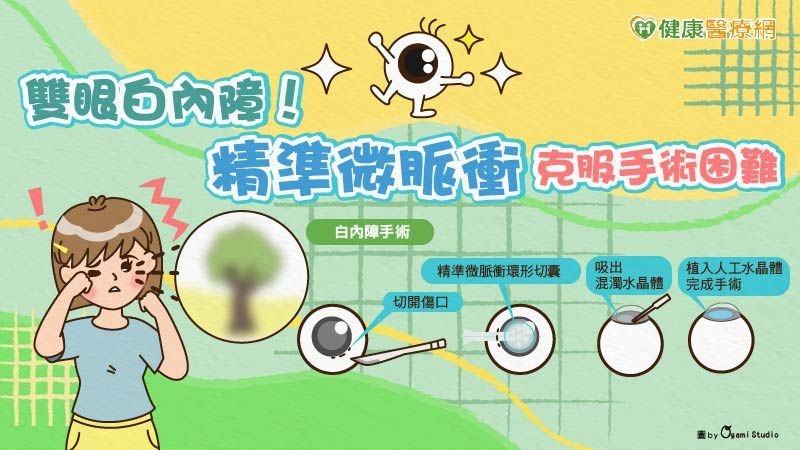 30多歲竟雙眼白內障！　宜蘭陽大附醫引進「精準微脈衝」嘉惠宜蘭鄉親